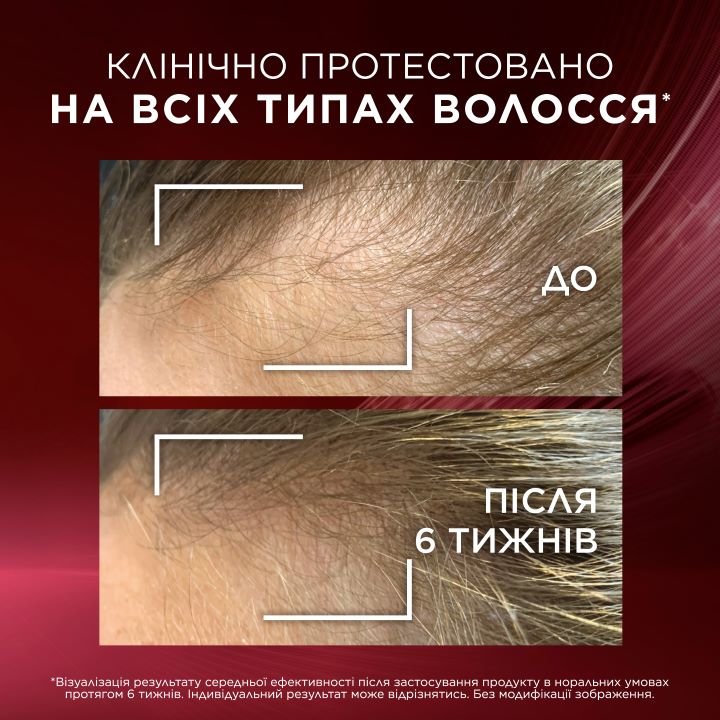 Elseve Ельсев Фул Резист Аргінін+Амінексил, Догляд за волоссям ...